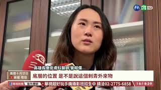 女背部刺青長出腫塊 竟罹基底細胞癌｜華視台語新聞 2020.12.04