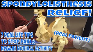 Spondylolisthesis Relief! 7 Real Life Tips to Stop Pain & Regain Normal Activity- Real Patient
