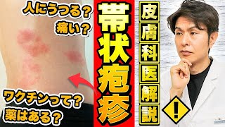 【3人に1人が発症？】帯状疱疹の原因・症状・治療法・ワクチンについて皮膚科専門医が解説【人にうつる？】