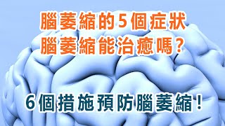 腦萎縮的5個症狀，腦萎縮能治癒嗎？ 6個措施預防腦萎縮！