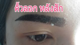 คิ้วลอกหลังสักทุกขั้นตอน/ Eyebrows tattoo