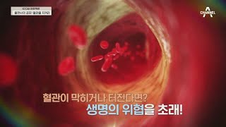 전조증상이 없는 혈관질환, 70%정도 막혔을때 비로소 증상을 느낀다?! | 100세 프로젝트 35 회