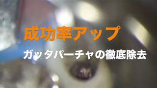 精密根管治療 　【愛知県刈谷市の歯医者】　ガッタパーチャ除去　再根管治療　１回で終わる　One Visit Root Canal Therapy　自由診療　顕微鏡歯科　マイクロスコープ　Kariya