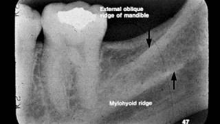 Dental Radiographic Anatomy