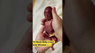 19 Week Baby Lived Only Minutes After Birth…🥺😢Miscarriage at 19 Weeks #shorts #short #shortsvideo
