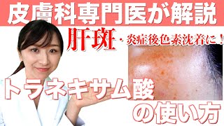 【肝斑に！】トラネキサム酸について皮膚科専門医が徹底解説！