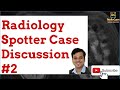 Radiology Cases - Spotters Set 2 : Quiz and Discussion