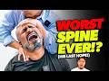 *THE STIFFEST SPINE* IVE 'EVER' CRACKED! 😱😭 | Asmr Chiropractor Back Pain Crack | Dr Tubio