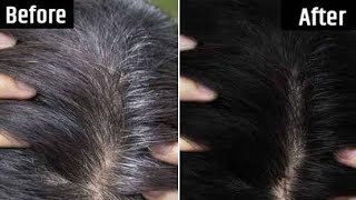 இளநரை நிரந்தரமாக போக Grey Hair to Black Naturally நரைமுடி கருப்பாகும் Hair Oil /White Hair Treatment