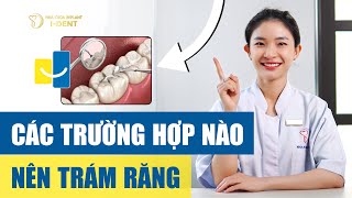 #2 Các trường hợp nào nên trám răng? | 3 PHÚT GIẢI ĐÁP