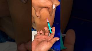 Titanus intramuscular injection 💉😱#doctor #trendingshorts #viralshorts