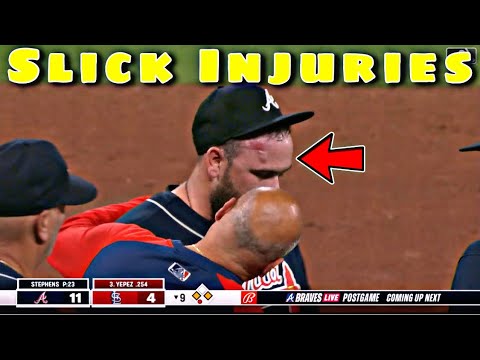 MLB | Slick Injuries V2 - YouTube