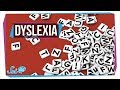 Dyslexia: When Your Brain Makes Reading Tricky