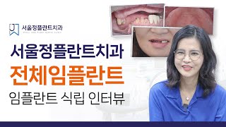 서울정플란트치과 - 환자인터뷰, 전체임플란트로 자신감을 되찾았어요.