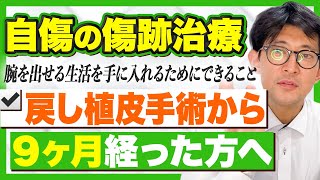 戻し植皮手術から9ヶ月経った患者様へ【きずときずあとのクリニック】