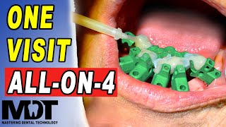 How to Make All on 4 in One Visit [ The Full Clinical and Lab Tutorial ]