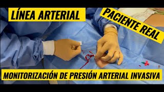 Linea arterial invasiva