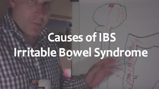 Causes of IBS - Irritable Bowel Syndrome