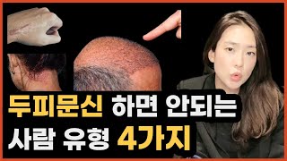 두피문신 후회 하지 말고 하기전 꼭 체크해야 할 사람 4가지