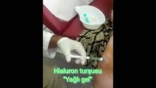 💉Hialuron turşusu _ hialuron gel _ qığırdaq yeyilməsi _ oynaq daxili inyeksiya _ artroz