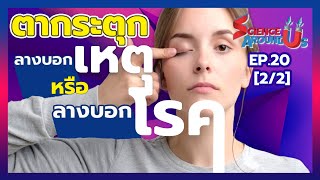 ตากระตุก ลางบอกเหตุ หรือลางบอกโรค | Science Around Us SS2 EP.20 [Part2/2]