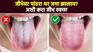 जिभेवर पांढरा थर जमा होतो ? ‘हे’ उपाय करा | How to Clean Tongue? | RI2