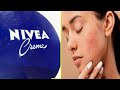 Nivea Cream VitaminE Capsule Beauty Tips to Remove Black Spots On Face | Skin Whitening NIVEA Cream