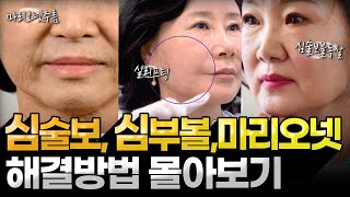 심술보, 심부볼, 마리오넷주름 해결방법 모음 zip