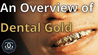 Dental Gold Value: What Are Grandpa’s Gold Teeth Really Worth?
