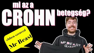 A Crohn betegség nem válogat: Mr Beast se menekült meg tőle