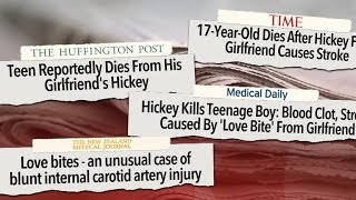Deadly hickey kills teenager