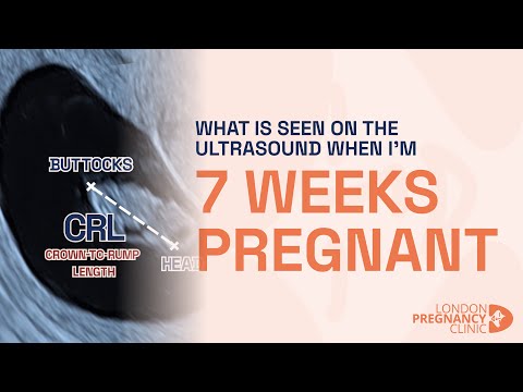 Can you hear a heartbeat at 7 weeks 6 days?