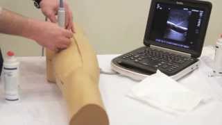 Ultrasound Guided Femoral Arterial Access