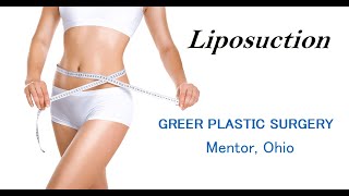 What is Liposuction? | A Doctor Answers | Greer Plastic Surgery