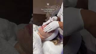 HYDRAFACIAL