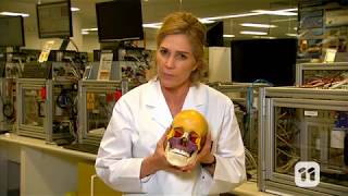 SCOPE TV: Bone Forensics