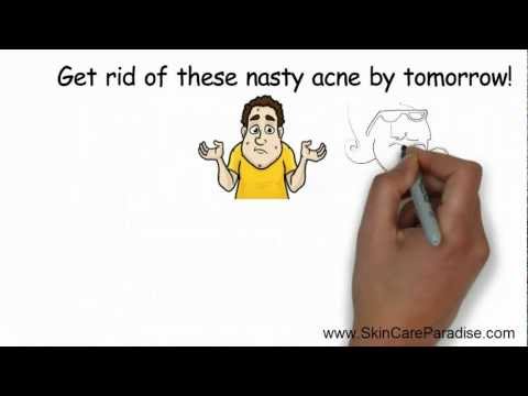 How To Get Rid Of Acne Overnight With Household Items In 5 Minutes How To Get Rid Of Acne Overnight With Household Items In 5 Minutes
