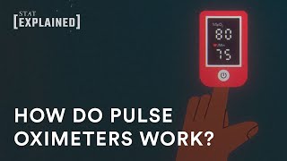 How pulse oximeters work, and why they sometimes do not