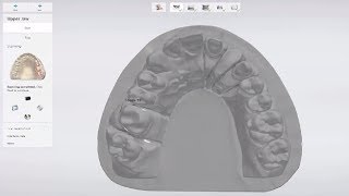 4. 3Shape E scanner - ScanIt Dental UI