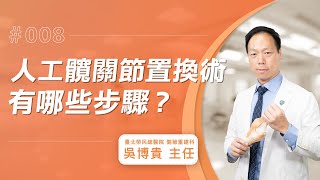 【人工髖關節Q\u0026A】什麼是人工髖關節置換術？有哪些步驟呢？│吳博貴主任