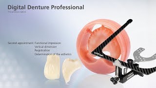 Digital Denture – second Appointment