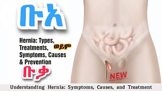 ሄርኒያ ወይም (ቡአ / ቡቃ) | የጤና ቃል | Understanding Hernia: Symptoms, Causes, and Treatment