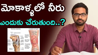 మోకాళ్ళలో నీరు ఎందుకు చేరుతుంది - తీసుకోవలసిన జాగ్రత్తలు | Water on the Knee (Joint Effusion)