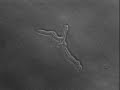 hyphae timeLapse single