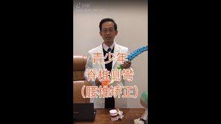 青少年脊椎側彎腰椎矯正｜謝教授談脊椎