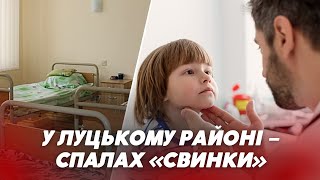 😨 У Луцькому районі у 5 дітей – “СВИНКА”: що відомо