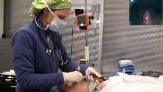 Video laryngoscope Tracheal intubation with Bougie Port