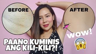 KILI-KILI CHICKEN SKIN TIPID SOLUTIONS