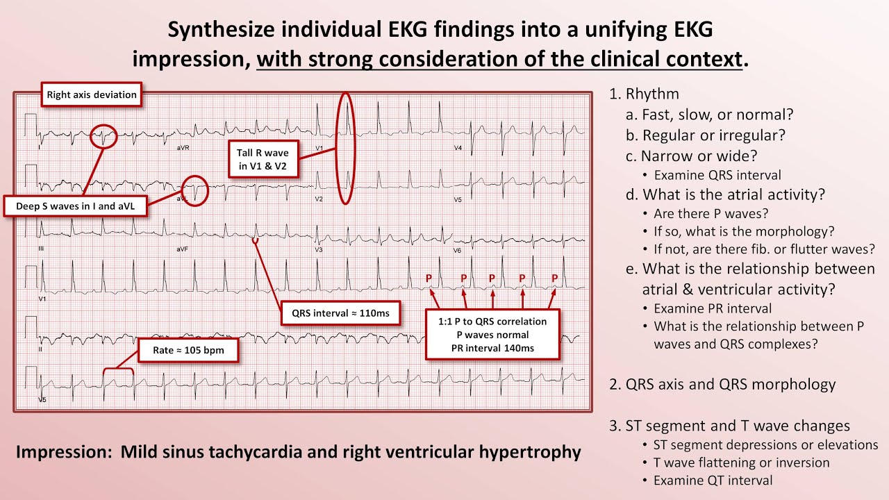 Reading Ekg Interpretation Basic How To Read An Ecg Interpretation