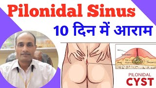 Pilonidal Sinus | Best Homeopathic Medicine for Pilonidal Cyst | Pilonidal Sinus Treatment